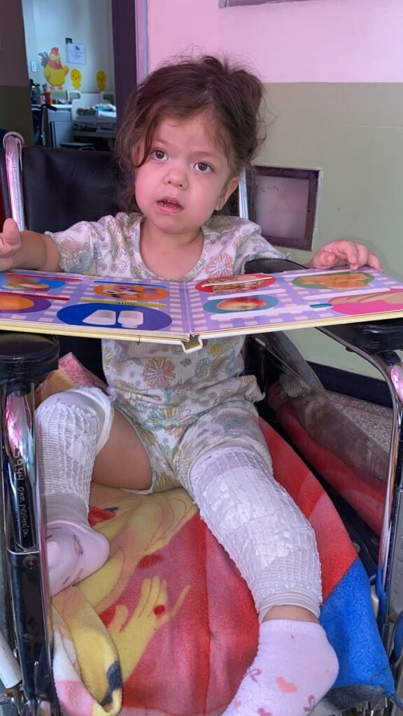 lili recuperandose de la cirugía